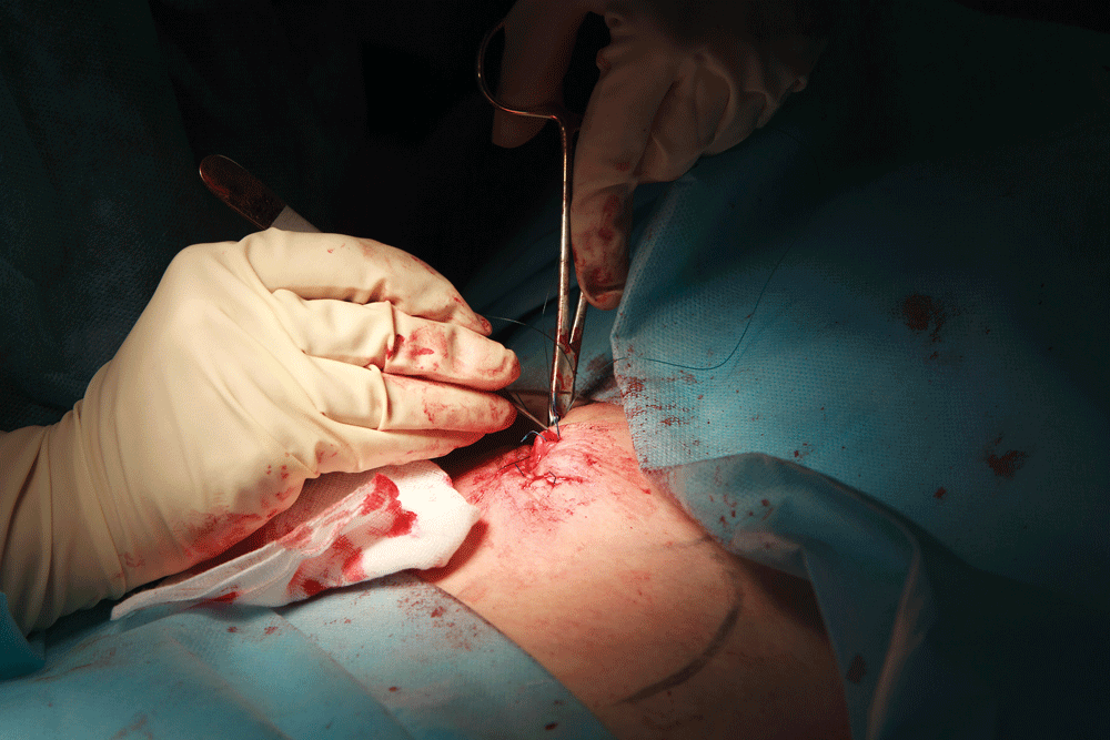Suturing 101: What I Learned From Dr Bones & Nurse Amy