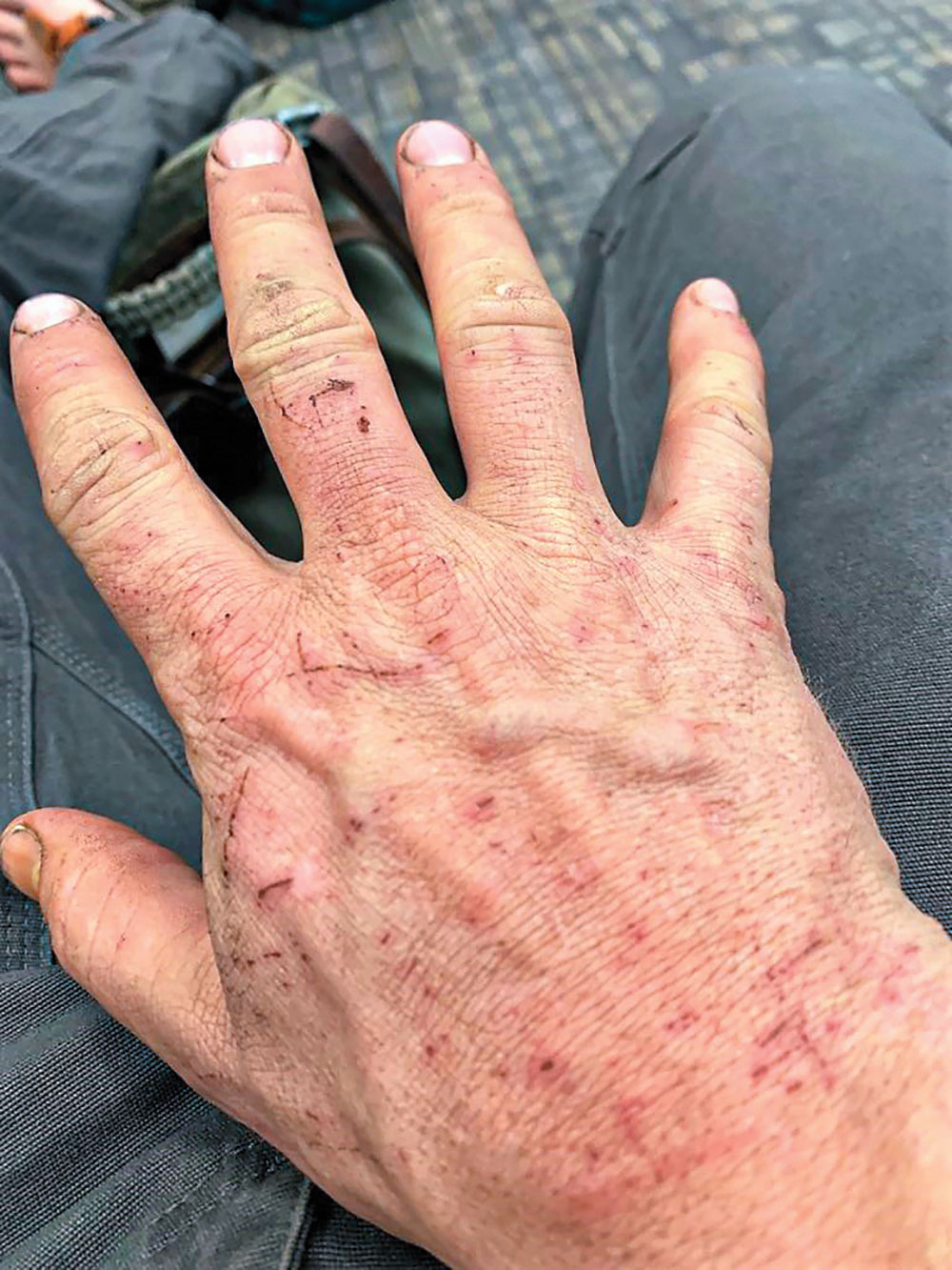 Student Dustin Hogard’s hands after a class