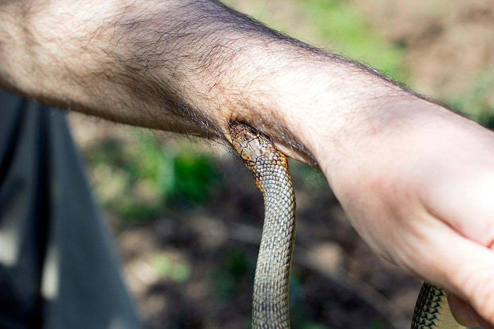 Snake bite